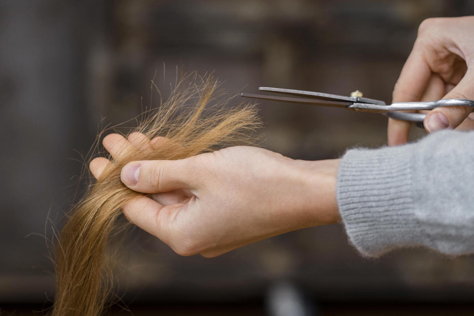 Unshaven Hair Transplant